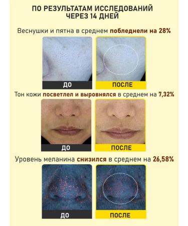 VELLA Cream - Night Mask lightening for the face and neck 10 pcs - Buy Online on GoSupps.com