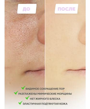 Skin 1004 MADAGASCAR Seborrial serum for a face with a centella of 100 ml of Korea - Buy Online on GoSupps.com