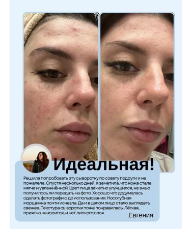 DREAM Moisturizing facial serum - Buy Online on GoSupps.com