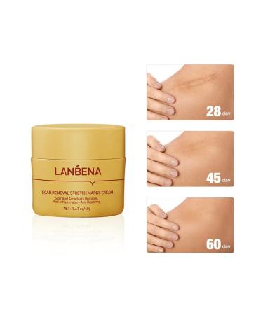 LANBENA from stretch marks post -acne scars set - Buy Online on GoSupps.com