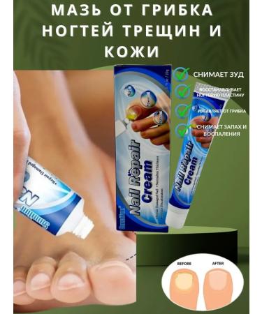 Antigritor ointment for legs natural cream
