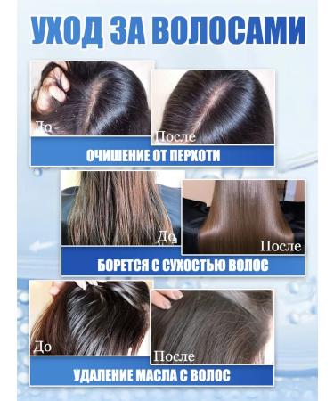 Hunmui Fanding the head of the scalp with dandruff - Buy Online on GoSupps.com