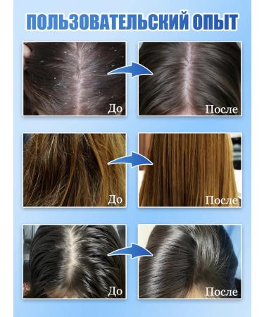 Hunmui Fanding the head of the scalp with dandruff - Buy Online on GoSupps.com