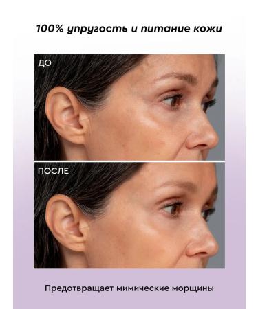 BOTAVIKOS Anti-Age face anti-aging - Buy Online on GoSupps.com