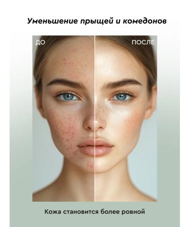 BOTAVIKOS Mating Cream-Gel Faces Intense Sos - Buy Online on GoSupps.com