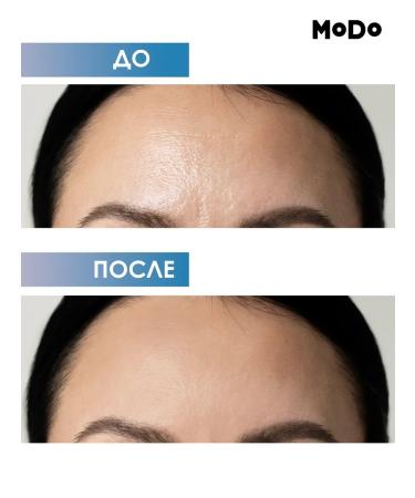 MODUM Modo Alice face cream for problem skin 2 pcs - Buy Online on GoSupps.com