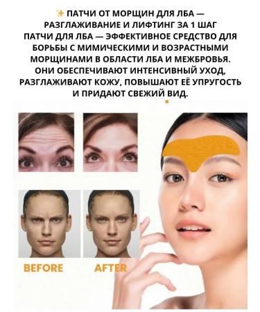 Vlar BEAUTY Paths from wrinkles for forehead 5 packs - Buy Online on GoSupps.com