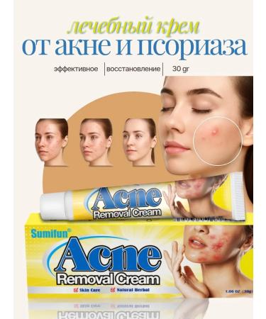 ABR Acne cream for problem skin from acne and acne psoriasis