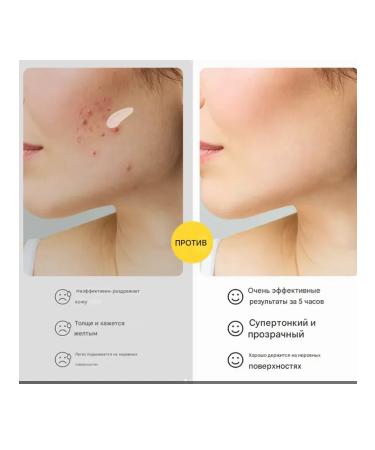 ABR Acne cream for problem skin from acne and acne psoriasis - Buy Online on GoSupps.com