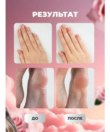 Totti Beauty Mask for the legs from cracks and for hands moisturizing - Buy Online on GoSupps.com