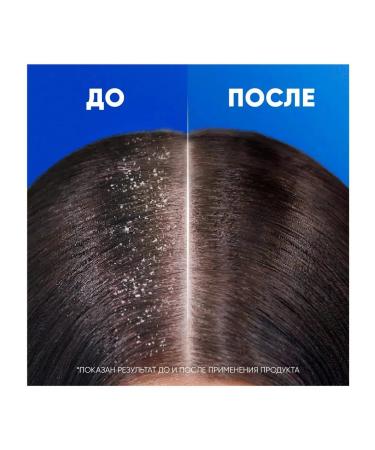 Head & Shoulders against dandruff menthol 1000ml - Buy Online on GoSupps.com