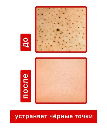 Dr Kirov / Dr Kirov Cosmetic Creams for problem skin from acne and spots - Buy Online on GoSupps.com