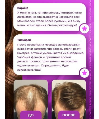 Lucas LV Hair growth serum - Buy Online on GoSupps.com