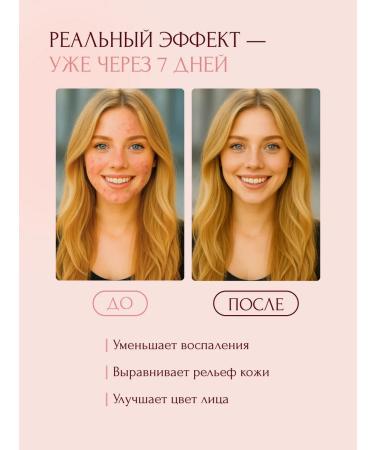 EVETIS Facial cream from acne and acne 50ml - Buy Online on GoSupps.com