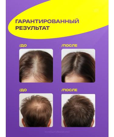 lvcos premium Hair growth with capxyl - Buy Online on GoSupps.com