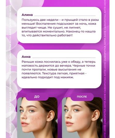 Lucas LV Facial serum from acne - Buy Online on GoSupps.com