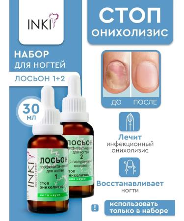 INKI Lotions 1 and 2 for the treatment of nails from onycholysis and fungus