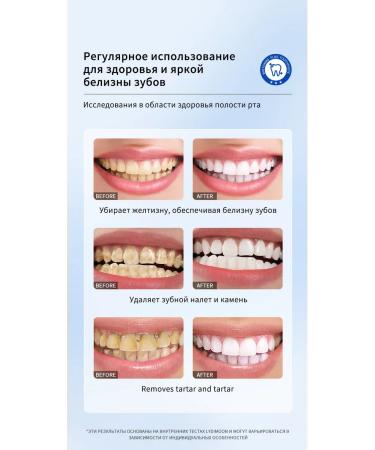 LYDIMOON whitening toothpaste 120g raid from smoking - Buy Online on GoSupps.com