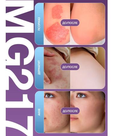 Capital Product Psoriasis cream mg217 - Buy Online on GoSupps.com