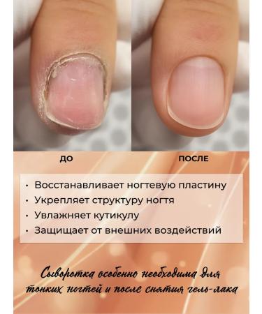 N20 Strengthening nail serum - Buy Online on GoSupps.com