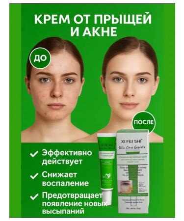 Everbloom Acne cream on the face of the shoulders of acne comedones - Buy Online on GoSupps.com