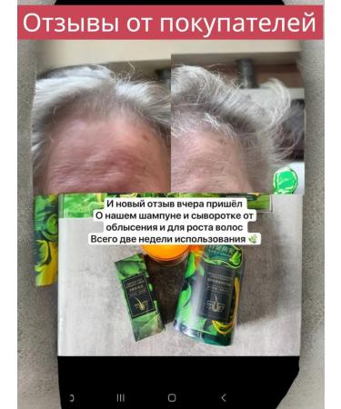 Greenleaf Eco Fully against hair loss Zhengai 30 ml - Buy Online on GoSupps.com