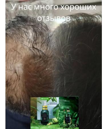 Greenleaf Eco Fully against hair loss Zhengai 30 ml - Buy Online on GoSupps.com