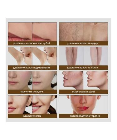 SHEFMON Hair growth correction device ml -ls707 - Buy Online on GoSupps.com