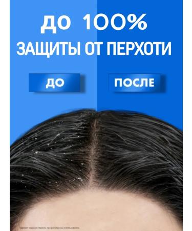 clear Male hair shampoo from dandruff with menthol 650 ml - Buy Online on GoSupps.com