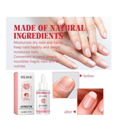 Eelhoe restoration thickening of gray nail treatment oil - Buy Online on GoSupps.com