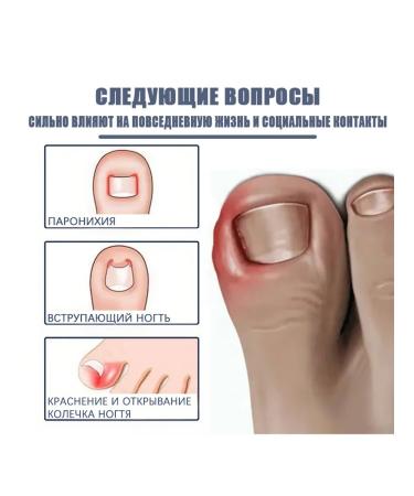 Nail care oil repair Disease rotten nails - Buy Online on GoSupps.com