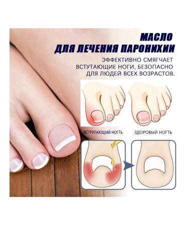 Nail care oil repair Disease rotten nails - Buy Online on GoSupps.com