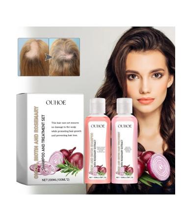 Onions+biotin strengthens hair stimulates growth