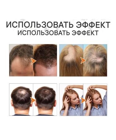 Onions+biotin strengthens hair stimulates growth - Buy Online on GoSupps.com