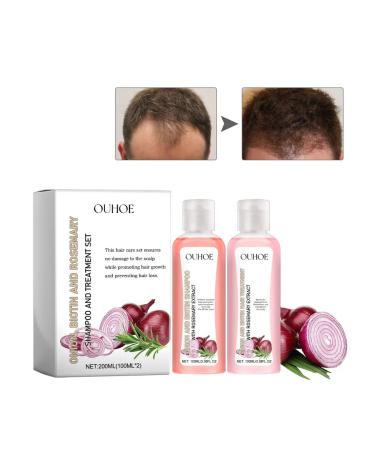Onions+biotin strengthens hair stimulates growth - Buy Online on GoSupps.com