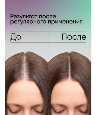 MATRIX Hair growth with rosemary - Buy Online on GoSupps.com