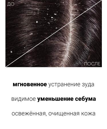 MASIL Cleaning lotion for the scalp 4pcs*15ml - Buy Online on GoSupps.com