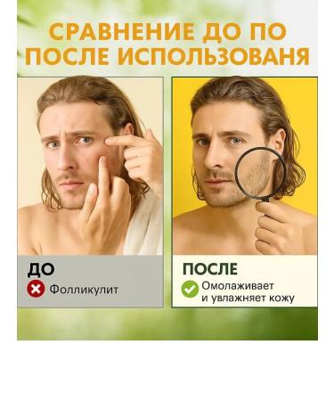m1llenium Cream from ingrown hair and folliculitis - Buy Online on GoSupps.com