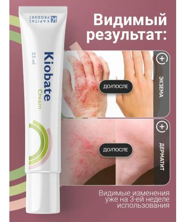 Capital Product Ointment from psoriasis and dermatitis - Buy Online on GoSupps.com
