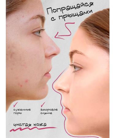 Capital pharm product Acne cream on the face and body of Elenaon a - Buy Online on GoSupps.com