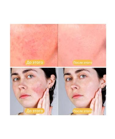 Eelhoe sunscreen for the face with SPF 50 3 pieces - Buy Online on GoSupps.com