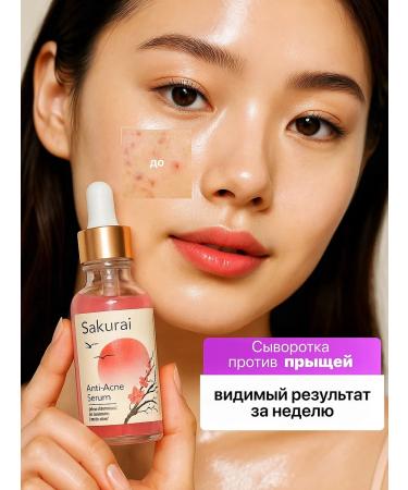 SAKURAI Acne with niacinamide