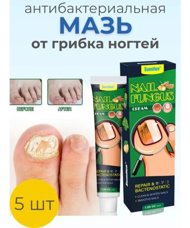 wwwbeauty Nail fungus cream
