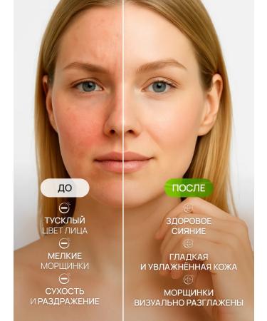 MEDIHEAL Moisturizing toner Pads for Korea's Faces - Buy Online on GoSupps.com