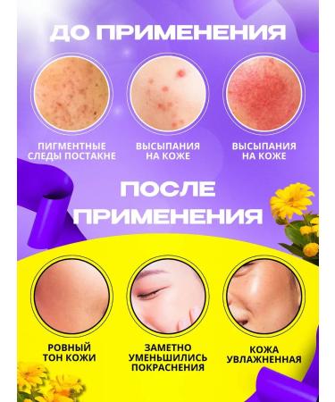 Traditional Chinese Medicine Acne cream and acne on the face and body 2 pieces - Buy Online on GoSupps.com