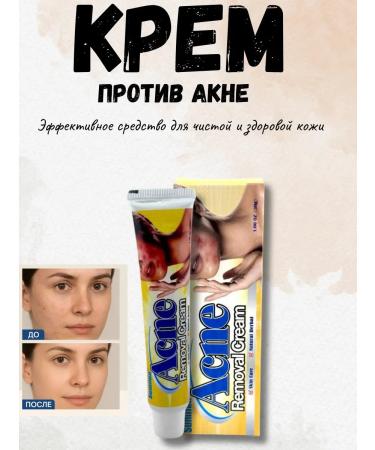 DDE intensive Anti-acne cream