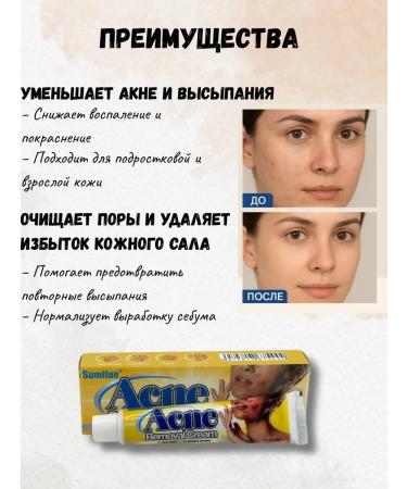 DDE intensive Anti-acne cream - Buy Online on GoSupps.com
