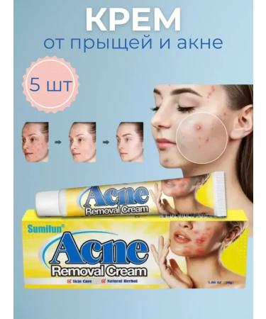 W HOME Acne cream acne and black dots