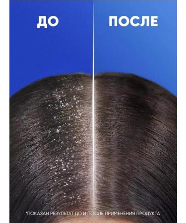 Head & Shoulders Hair shampoo from dandruff male Men Ultra 400ml - Buy Online on GoSupps.com