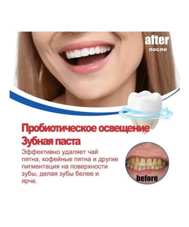 Probiotic white toothpaste cleaning the company Delete the smell - Buy Online on GoSupps.com